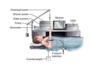 Arthroscopy of Ankle and Wrist