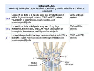 Arthroscopy of Ankle and Wrist