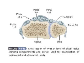 Arthroscopy of Ankle and Wrist
