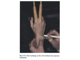 Arthroscopy of Ankle and Wrist