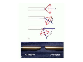 Arthroscopy of Ankle and Wrist