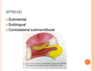 SPREAD
 Submental
 Sublingual
 Contralateral submandibular
 
