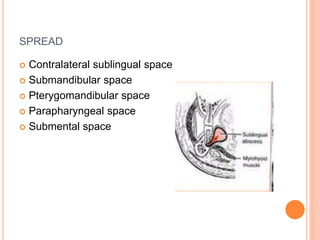 SPREAD
 Contralateral sublingual space
 Submandibular space
 Pterygomandibular space
 Parapharyngeal space
 Submental space
 
