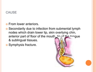 CAUSE
 From lower anteriors.
 Secondarily due to infection from submental lymph
nodes which drain lower lip, skin overlying chin,
anterior part of floor of the mouth, tip of the tongue
& sublingual tissues.
 Symphysis fracture.
 