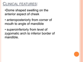CLINICAL FEATURES:
•Dome shaped swelling on the
anterior aspect of cheek
• anteroposteriorly from corner of
mouth to angle of mandible
• superoinferiorly from level of
zygomatic arch to inferior border of
mandible.
 