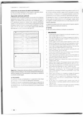 Manejo arritmias sintomáticas