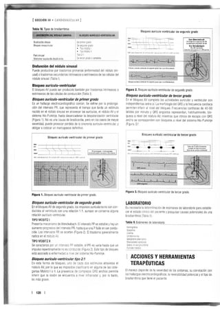 Manejo arritmias sintomáticas