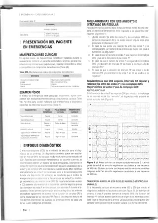 Manejo arritmias sintomáticas