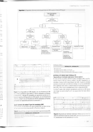 Manejo arritmias sintomáticas