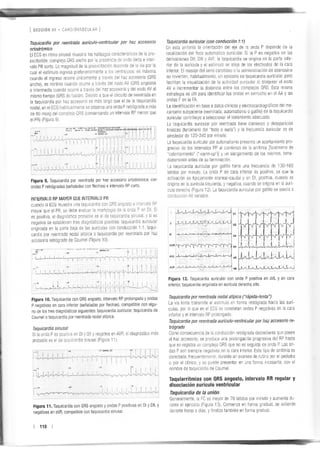 Manejo arritmias sintomáticas