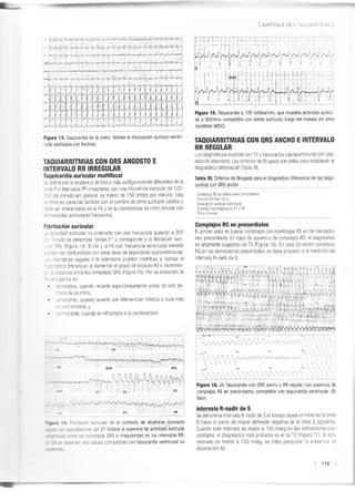 Manejo arritmias sintomáticas
