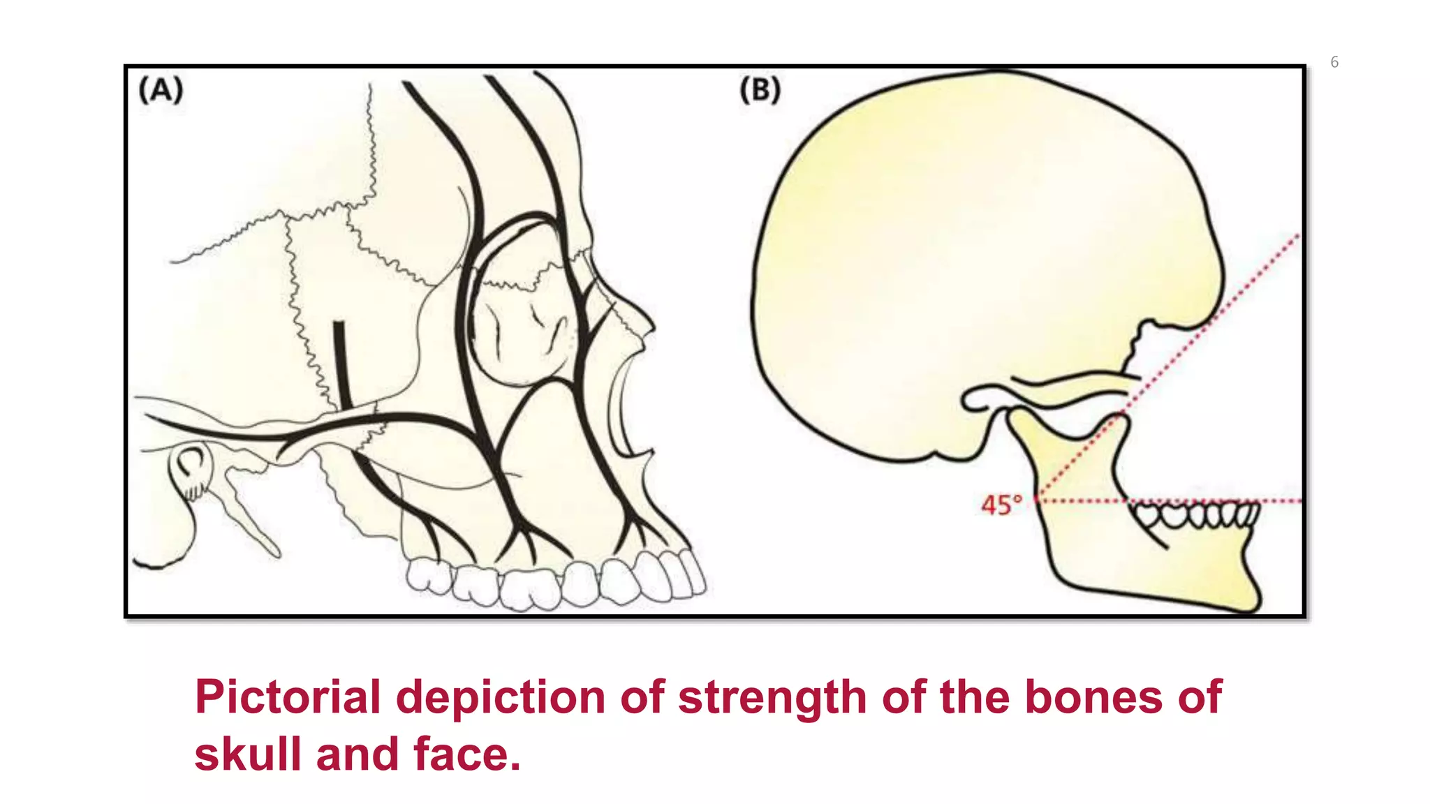 6
Pictorial depiction of strength of the bones of
skull and face.
 