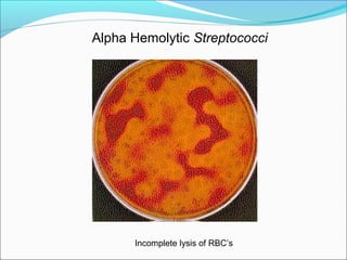 Alpha Hemolytic Streptococci 
Incomplete lysis of RBC’s 
 