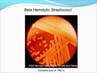 Beta Hemolytic Streptococci 
Complete lysis of RBC’s 
 