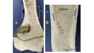 Trabecular
A B
Figure 50.5
 