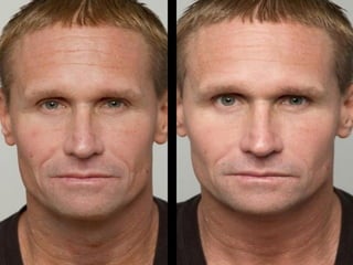 2 minute miracle gel skin care results