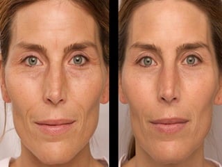 2 minute miracle gel skin care results