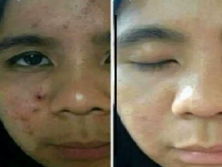 2 minute miracle gel skin care results