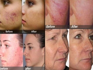 2 minute miracle gel skin care results