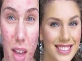 2 minute miracle gel skin care results