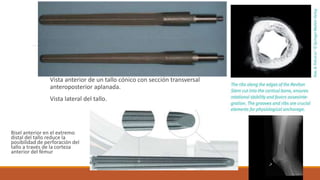 Vastago de titanio femoral para revision de ARtroplastia de rodilla | PPTX