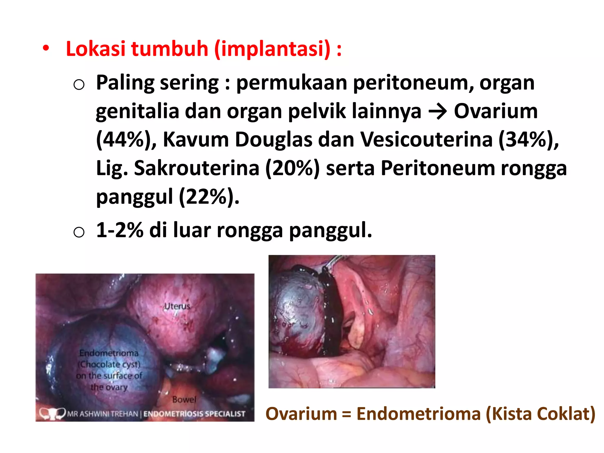 Tranny uning eshagiga kiradi (kesilgan)