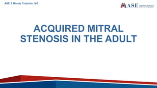 ACQUIRED MITRAL
STENOSIS IN THE ADULT
ASE 2 Minute Tutorials: MS
 