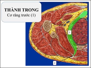 THÀNH TRONG
Cơ răng trước (1)
 