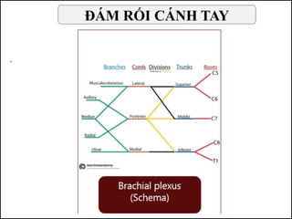 ĐÁM RỐI CÁNH TAY
 