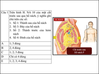 Câu 1 Trên hình H. NA 10 của mặt cắt
trước sau qua hố nách, ý nghĩa ghi
chú trên các số:
1. Số 1: Thành sau của hố nách
2. Số 3: Đáy của hố nách
3. Số 2: Thành trước của hỏm
nách
4. Số 4: Đỉnh của hố nách
A 1; 3 đúng
B 2; 4 đúng
C 1; 2; 3 đúng
D Chỉ có 4 đúng
E 1; 2; 3; 4 đúng
 