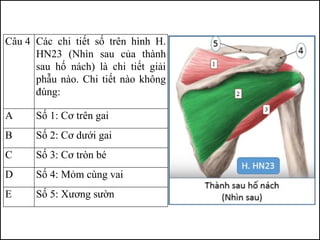 Câu 4 Các chi tiết số trên hình H.
HN23 (Nhìn sau của thành
sau hố nách) là chi tiết giải
phẫu nào. Chi tiết nào không
đúng:
A Số 1: Cơ trên gai
B Số 2: Cơ dưới gai
C Số 3: Cơ tròn bé
D Số 4: Mỏm cùng vai
E Số 5: Xương sườn
 