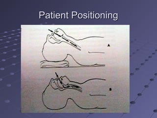 Patient PositioningPatient Positioning
 