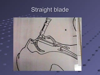 Straight bladeStraight blade
 