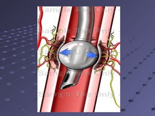 Anesthesia 5th year, 2nd, 3rd, & 4th lectures (Dr. Gona)