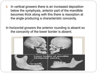 Development of mandible | PPTX