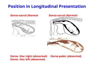 2nd Fetal Presentations.ppt kkkkkkkkkkkk | PPT