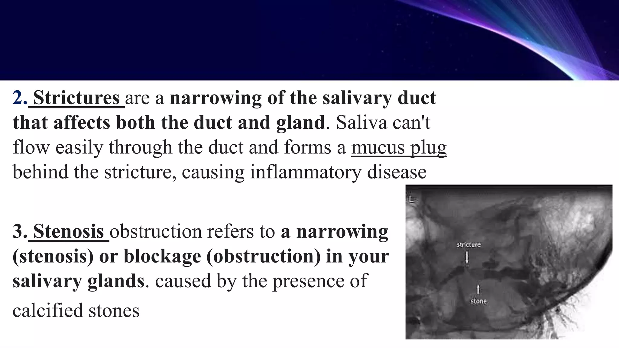 salivary gland disorder.pptx