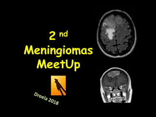 2 nd
Meningiomas
MeetUp
 