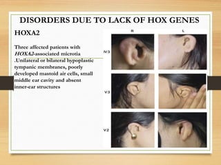 hox genes and its role in development | PPTX