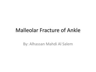 Malleolar Fracture of Ankle
By: Alhassan Mahdi Al Salem
 