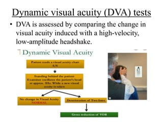 Dva Testing Chart Vestibular function tests | PPTX