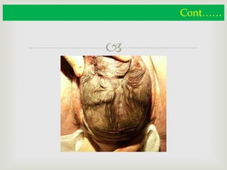 
Cont……
 