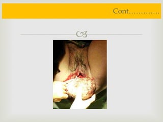 
Cont………….
 