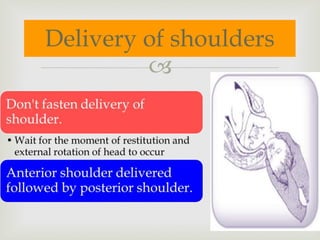 
Delivery of shoulders
 
