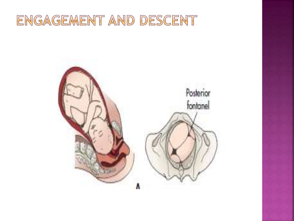 NURSING MANAGEMENT OF SECOND STAGE OF LABOUR