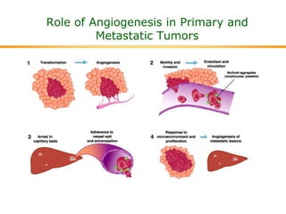 Role of Angiogenesis in Primary and
Metastatic Tumors
 