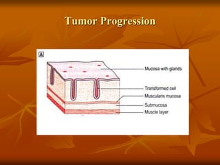 Tumor Progression
 