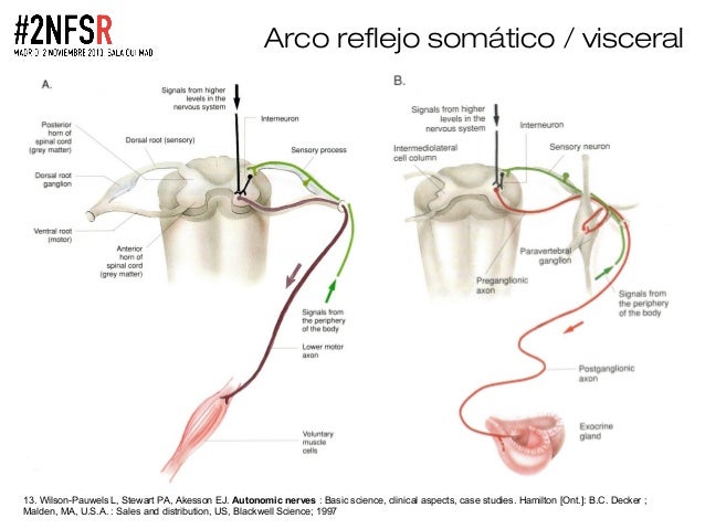 Aprender cómo dolor muscular antebrazo