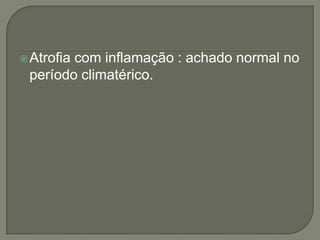 Atrofia com inflamação : achado normal no
período climatérico.
 