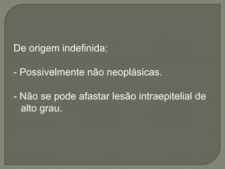 De origem indefinida:
- Possivelmente não neoplásicas.
- Não se pode afastar lesão intraepitelial de
alto grau.
 